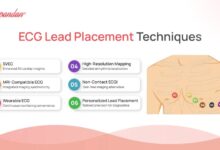 leads ecg placement