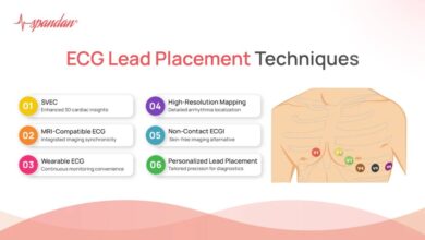 leads ecg placement