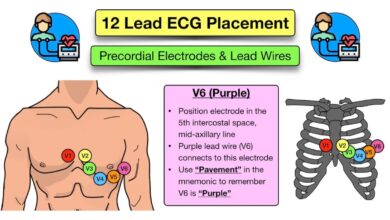 leads on ecg